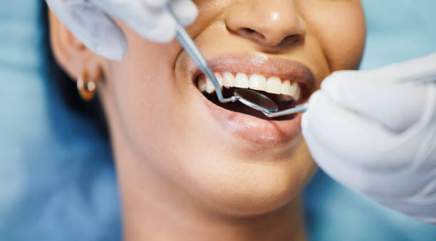 Best Emergency Gum Treatment in Morocco, IN