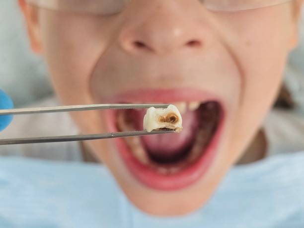 Best Pediatric Emergency Dentist in Morocco, IN